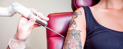 Tattoo Removal in Las Vegas: Busting Common Myths